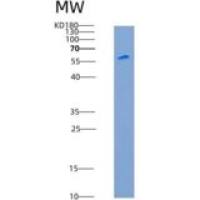 大鼠CADM3 / NECL1 / IGSF4B重组蛋白Fc tag