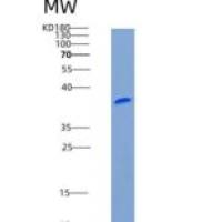 大鼠CD99分子(CD99)重组蛋白Fc tag
