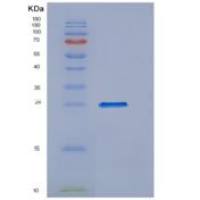 小鼠血清淀粉样蛋白P重组蛋白His Tag