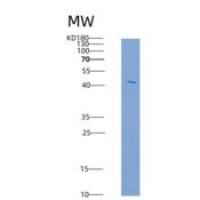 大鼠内皮细胞粘附分子(ESAM)重组蛋白Fc tag