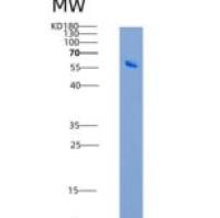 人IL17BR / IL17RB / IL-17 Receptor B重组蛋白Fc tag