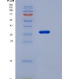 小鼠Fetuin-A / AHSG重组蛋白His tag