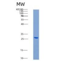 小鼠TFPI / LACI / EPI重组蛋白His tag