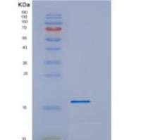 人TREML1 / TLT-1重组蛋白His tag