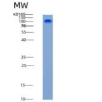 大鼠E-Cadherin / CDH1 / E-cad / CD324重组蛋白Fc tag