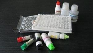 人EB病毒(EBV)酶联免疫分析试剂盒使用说明书