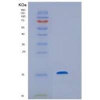 小鼠XEDAR / EDA2R重组蛋白His tag