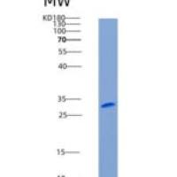 人CD1D / R3G1重组蛋白His tag