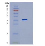 人同线蛋白2(ST2)重组蛋白isoform a, His 