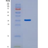 大鼠CD14分子(CD14)重组蛋白His tag