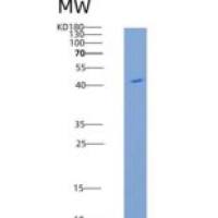 人Angiotensinogen / SerpinA8 / AGT重组蛋白His tag