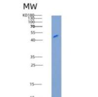 小鼠SerpinD1 / HCII重组蛋白His tag