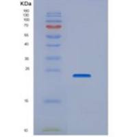 人SLAMF6 / Ly108重组蛋白