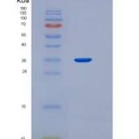 人Galectin-8 / LGALS8重组蛋白
