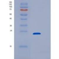 人SLAMF6 / Ly108重组蛋白His tag