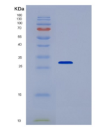 人核糖核酸酶T2(RNASET2)重组蛋白His tag