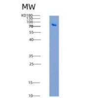 小鼠Thimet脱寡肽酶1(THOP1)重组蛋白His tag