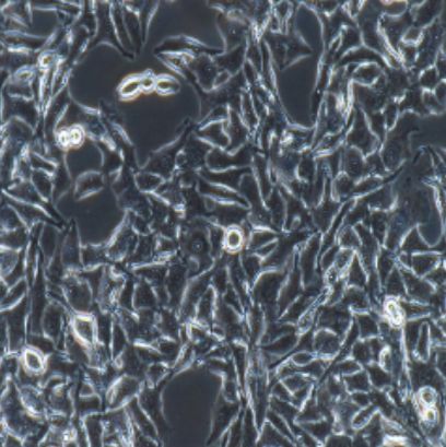 小鼠黑色素瘤转染表达OVA,B16-OVA