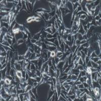 小鼠黑色素瘤转染表达OVA,B16-OVA