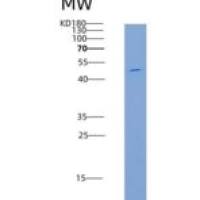 大鼠CD48 / SLAMF2 / BCM1重组蛋白Fc tag