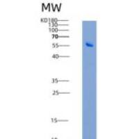 小鼠CD96重组蛋白His Tag