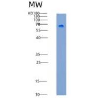 人艾杜糖醛酸2-硫酸酯酶/ IDS重组蛋白His tag