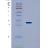 人核糖核酸酶T2(RNASET2)重组蛋白His tag