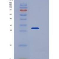 人核糖核酸酶T2(RNASET2)重组蛋白His tag