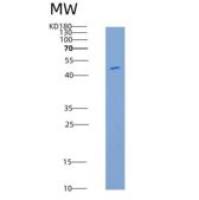 人IL7RA / CD127重组蛋白His & Fc tag