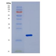 小鼠CD276分子(CD276)重组蛋白His Tag