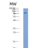 小鼠Nogo Receptor / NOGOR / RTN4R重组蛋白His & Fc tag