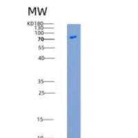 小鼠Nogo Receptor / NOGOR / RTN4R重组蛋白His & Fc tag