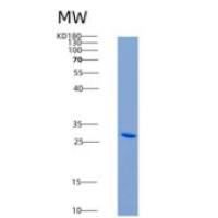 人TNFR2 / CD120b / TNFRSF1B重组蛋白aa 1-268, 196 Met/Arg, His tag