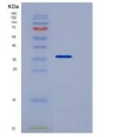 人Neurexin-3-beta / NRXN3重组蛋白His tag