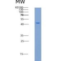 小鼠CD137重组蛋白Fc Tag