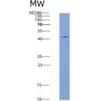 人ROBO4重组蛋白His Tag