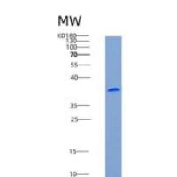 人GPR56 / TM7LN4重组蛋白His tag