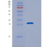人NUDT5 / ADP-sugar Pyrophosphatase重组蛋白His tag
