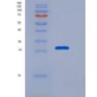 人NUDT5 / ADP-sugar Pyrophosphatase重组蛋白His tag