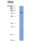 大鼠CD14分子(CD14)重组蛋白Fc tag