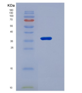 小鼠Fetuin-A / AHSG重组蛋白His tag