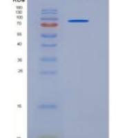 小鼠PSMA / FOLH1重组蛋白His tag