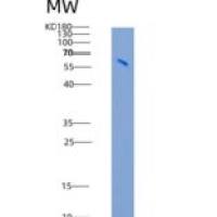 人PPP3CA /蛋白磷酸酶2B重组蛋白His tag