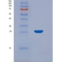 小鼠IL7R alpha重组蛋白His Tag