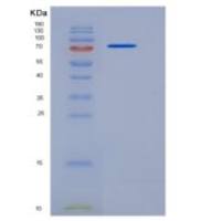 小鼠Siglec-2 / CD22重组蛋白His tag