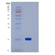 人XEDAR / EDA2R重组蛋白His tag