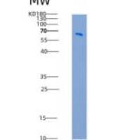 大鼠TrkA / NTRK1重组蛋白Fc tag