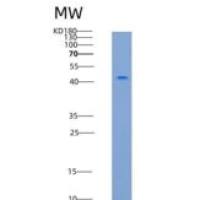 小鼠STHM / ST6GALNAC2重组蛋白His tag