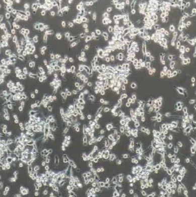 小鼠结肠癌细胞转染表达OVA，MC38-OVA