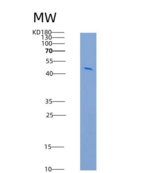 人基质金属蛋白酶7(MMP7)重组蛋白Fc tag